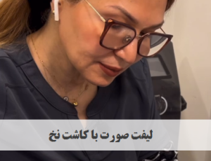 لیفت صورت با کاشت نخ | دکتر ژیلا عبدی