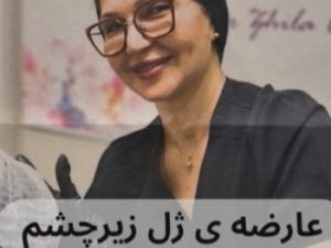 عارضه ژل زیر چشم